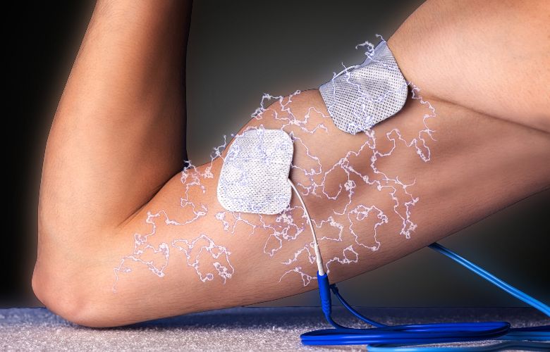 What Is Electrical Muscle Stimulation